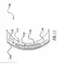 Fig. 09 - Electro-active multi-focal spectacle lens