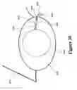 Fig. 24 - Electro-active multi-focal spectacle lens