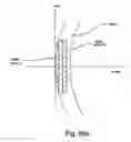 Fig. 61 - Electro-active multi-focal spectacle lens