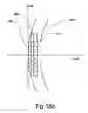 Fig. 62 - Electro-active multi-focal spectacle lens