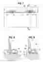 Fig. 04 - Scraped heat exchanger having blade with protective rest nub