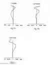 Fig. 03 - Objective optical system for optical recording media and optical pickup device using it