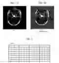 Fig. 02 - System and method for robust reversible data hiding and data recovery in the spatial domain