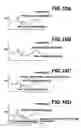 Fig. 09 - Method, apparatus, and program for discriminating calcification patterns