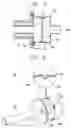 Fig. 06 - Reciprocating compressor having assembly structure of suction muffler