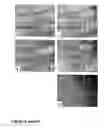 Fig. 07 - Methods of treating neurological conditions with hematopoietic growth factors
