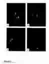 Fig. 08 - Methods of treating neurological conditions with hematopoietic growth factors