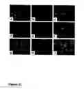 Fig. 43 - Methods of treating neurological conditions with hematopoietic growth factors