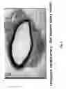 Fig. 09 - Soft tissue implants and anti-scarring agents