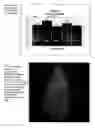 Fig. 15 - Methods for fabrication, uses and compositions of small spherical particles of hGH prepared by controlled phase separation