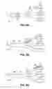 Fig. 07 - Compositions for achieving a therapeutic effect in an anatomical structure