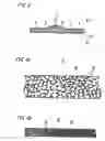 Fig. 03 - Orthotic apparatus and sheet with laminated structure