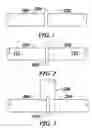 Fig. 02 - Composite medical device having a titanium or titanium based alloy section and a ferrous metal section