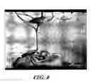 Fig. 05 - Composite medical device having a titanium or titanium based alloy section and a ferrous metal section