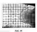 Fig. 07 - Composite medical device having a titanium or titanium based alloy section and a ferrous metal section
