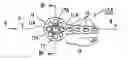 Fig. 01 - Orthodontic anchor