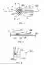 Fig. 02 - Orthodontic anchor