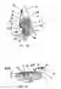 Fig. 06 - Orthodontic anchor
