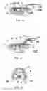 Fig. 07 - Orthodontic anchor