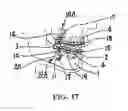 Fig. 08 - Orthodontic anchor