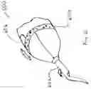 Fig. 09 - Dental tool having a hand grip