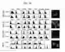 Fig. 03 - Novel dendritic cell-specific polynucleotides and microarray comprising the same