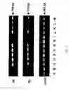 Fig. 06 - Molecular lymphatic mapping of sentinel lymph nodes