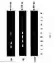 Fig. 07 - Molecular lymphatic mapping of sentinel lymph nodes