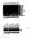 Fig. 08 - Methods and probes for diagnosing a gynaecological condition
