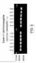 Fig. 28 - High bone mass gene of 11q13.3