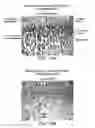 Fig. 30 - High bone mass gene of 11q13.3