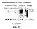 Fig. 33 - High bone mass gene of 11q13.3