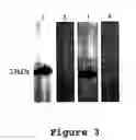 Fig. 04 - Covalently reactive transition state analogs and methods of use thereof