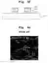 Fig. 08 - Method of forming bump pad of flip chip and structure thereof