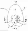 Fig. 01 - Armband