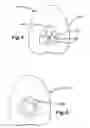 Fig. 03 - Armband