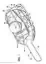 Fig. 02 - Projectile catching and throwing toy