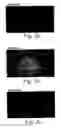 Fig. 03 - Methods of inhibiting and treating bacterial biofilms by metal chelators