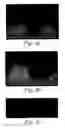 Fig. 08 - Methods of inhibiting and treating bacterial biofilms by metal chelators