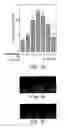 Fig. 09 - Methods of inhibiting and treating bacterial biofilms by metal chelators