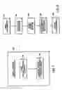 Fig. 08 - Method for subretinal administration of therapeutics including steroids; method for localizing pharmacodynamic action at the choroid of the retina; and related methods for treatment and/or prevention of retinal diseases
