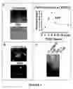 Fig. 05 - CB2 receptors blocks accumulation of human hepatic myofibroblasts: a novel artifibrogenic pathway in the liver