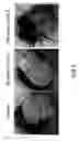 Fig. 02 - Method of inhibiting angiogenesis