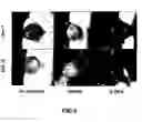 Fig. 06 - Method of inhibiting angiogenesis