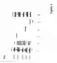 Fig. 05 - Tryparedoxin, expression plasmid, process of preparation, method of use, test kit and pharmaceutical composition