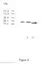 Fig. 10 - Tryparedoxin, expression plasmid, process of preparation, method of use, test kit and pharmaceutical composition