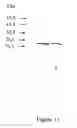 Fig. 12 - Tryparedoxin, expression plasmid, process of preparation, method of use, test kit and pharmaceutical composition