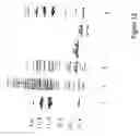 Fig. 13 - Tryparedoxin, expression plasmid, process of preparation, method of use, test kit and pharmaceutical composition