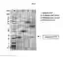 Fig. 09 - Stoichiometric conjugates of biocompatible polymers at the unpaired cysteine residue of the wild-type G-CSF
