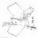 Fig. 05 - Transobturator surgical articles and methods